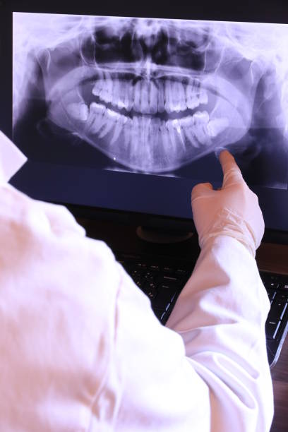 Best Knocked-Out Tooth (Avulsed Tooth) Treatment in Lake Jackson, TX