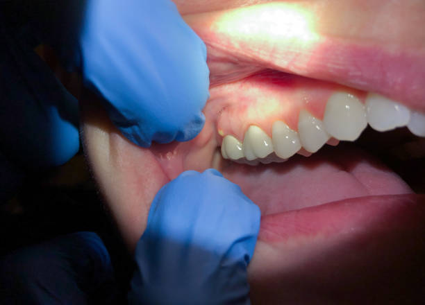 Best Emergency Denture Repair in Lake Jackson, TX
