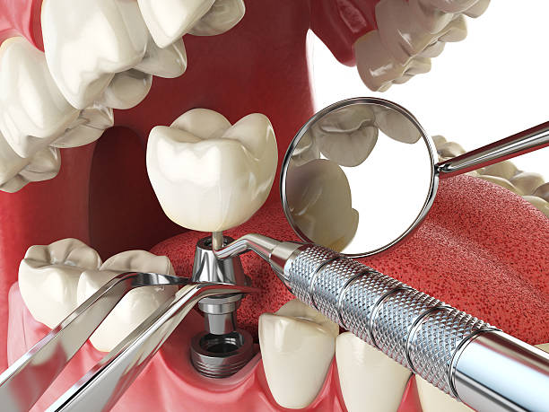 Best Walk-In Emergency Dental Services in Lake Jackson, TX